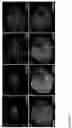 Fig. 11 - A SYSTEM AND METHOD FOR MICROSCOPY