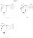 Fig. 12 - Electronic device for virtual reality (VR), augmented reality (AR), or mixed reality (MR)