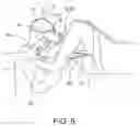 Fig. 05 - MEDICAL MAGNIFICATION DEVICE