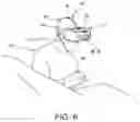 Fig. 06 - MEDICAL MAGNIFICATION DEVICE