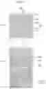 Fig. 06 - Liquid crystal display comprising a pixel electrode having a transverse stem, a longitudinal stem, and a plurality of minute branches
