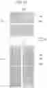 Fig. 15 - Liquid crystal display comprising a pixel electrode having a transverse stem, a longitudinal stem, and a plurality of minute branches
