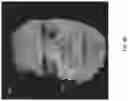 Fig. 09 - Real-time tracking for three-dimensional imaging