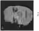 Fig. 10 - Real-time tracking for three-dimensional imaging