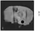Fig. 11 - Real-time tracking for three-dimensional imaging