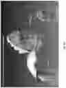 Fig. 17 - Real-time tracking for three-dimensional imaging