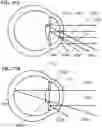 Fig. 08 - Holographic Waveguide Optical Tracker