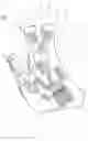 Fig. 01 - Hand-wearable device and manufacturing method therefor
