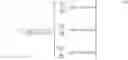 Fig. 03 - Apparatus for processing a signal