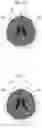 Fig. 07 - Medical image processing apparatus, medical image processing method, and medical image processing program