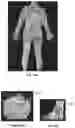 Fig. 32 - Systems and methods for positioning an object