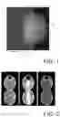 Fig. 02 - Scaled radiography reconstruction