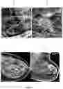 Fig. 05 - Systems and methods for automated detection of an indication of malignancy in a mammographic image