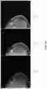 Fig. 06 - Systems and methods for automated detection of an indication of malignancy in a mammographic image