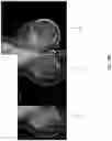 Fig. 07 - Systems and methods for automated detection of an indication of malignancy in a mammographic image