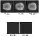 Fig. 13 - Systems and methods for magnetic resonance image reconstruction