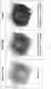Fig. 09 - Extended high efficiency computed tomography with optimized recursions and applications