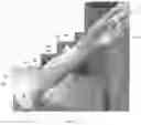 Fig. 08 - Portable multifunctional anatomical model for medical training