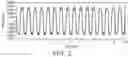 Fig. 03 - Magnetic recording device supplied with varying recording current