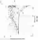Fig. 14 - Row hammer refresh for content-addressable memory devices
