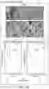 Fig. 17 - APPARATUS, SYSTEMS, AND METHODS FOR RAPID CANCER DETECTION