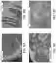 Fig. 24 - APPARATUS, SYSTEMS, AND METHODS FOR RAPID CANCER DETECTION