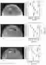 Fig. 35 - Monochromatic x-ray component systems and methods