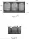 Fig. 09 - High density coil design and process