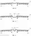 Fig. 12 - Interkey support for keyboards