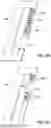 Fig. 15 - Compact high voltage power fuse and methods of manufacture