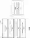 Fig. 09 - One transistor and one ferroelectric capacitor memory cells in diagonal arrangements