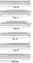 Fig. 06 - Implantable electrode and method for manufacturing