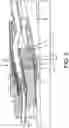 Fig. 04 - Systems and methods for sealing motor lead extensions