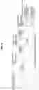 Fig. 06 - Edge detection signal processing