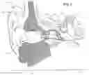 Fig. 02 - Adjustable venting for hearing instruments