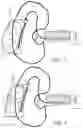 Fig. 03 - Modular hearing aid
