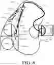 Fig. 06 - Modular hearing aid