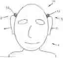 Fig. 01 - Method for operating a hearing system and hearing system comprising two hearing devices
