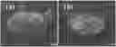 Fig. 01 - Antibacterial hydrophilic compound and use thereof
