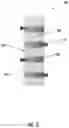 Fig. 04 - Aerosol delivery device with conductive inserts