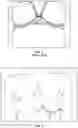 Fig. 03 - Chest wall adapter device