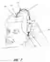 Fig. 06 - HEAD ITCH RELIEF TOOL