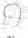 Fig. 07 - HEAD ITCH RELIEF TOOL