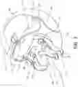 Fig. 04 - Helmet with cheek pads and method for the use thereof