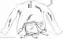 Fig. 01 - ARTICLES INCORPORATED INTO AN ATTACHED POUCH