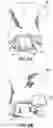 Fig. 09 - ARTICLES INCORPORATED INTO AN ATTACHED POUCH
