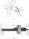 Fig. 07 - A PILLOW ASSEMBLY AND A BODY THEREOF