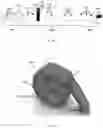 Fig. 11 - A PILLOW ASSEMBLY AND A BODY THEREOF