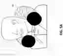 Fig. 06 - Expandable body contouring pillow