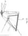 Fig. 16 - Cleaning tool for an extractor